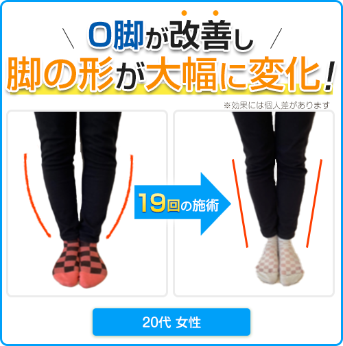 ビフォーアフター