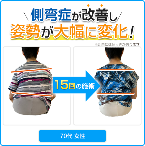 ビフォーアフター